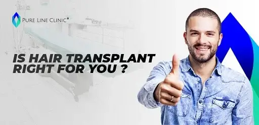 Is a hair transplant right for you?